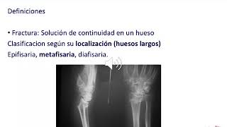 GENERALIDADES DE ORTOPEDIA Y TRAUMATOLOGIA [upl. by Baiss]