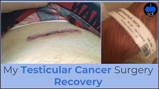 My Testicular Cancer Surgery Recovery [upl. by Nanor501]