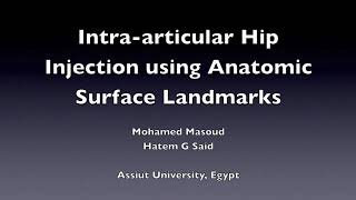 IntraArticular Hip Injection Using Anatomic Surface Landmarks [upl. by Darees]