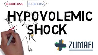 Hypovolemic shock  Introduction amp Causes [upl. by O'Donovan]