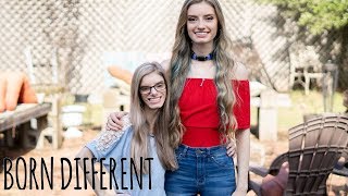 My Identical Twin With Dwarfism  BORN DIFFERENT [upl. by Shae994]