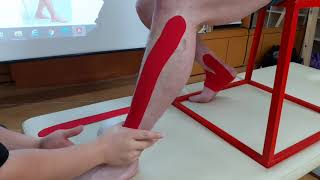 Kinesio taping  Tibialis Anterior [upl. by Stephenie428]