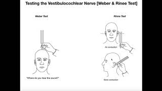 Interpreting the WeberRinne Tests EXPLAINED [upl. by Tesil]