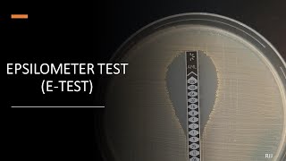 ETest Epsilometer Test [upl. by Ronacin]