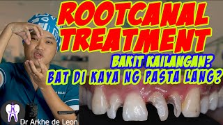 Root Canal Treatment or Therapy Explained ENG CC 51 [upl. by Wayne107]