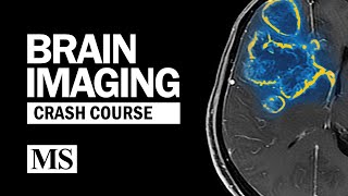 Brain Imaging Crash Course [upl. by Ramad188]