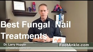 What are the Best Treatments for Fungal Toenails  Seattle Podiatrist Larry Huppin [upl. by Nairadal]