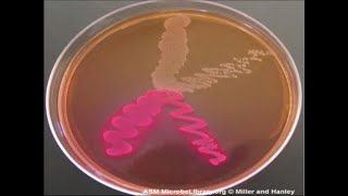 Micro Lab 6 Selective and Differential Media [upl. by Akeimahs]