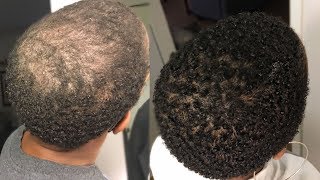 My 100 Natural HAIR GROWTH Serum  2 Month Update  GrowWithMe  Nia Hope [upl. by Pet702]