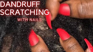 Dandruff Scratching with NAILS [upl. by Grefer]