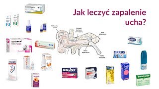 Jak leczyć zapalenie ucha [upl. by Jens329]