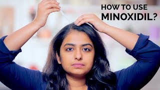 How To Use Minoxidil  Hair Regrowth  Skin Diaries [upl. by Ronica]