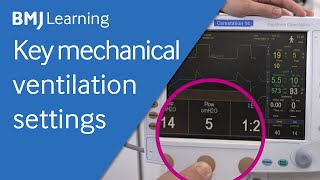 Key settings for a mechanical ventilator  BMJ Learning [upl. by Ihpen]