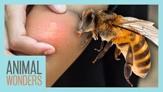 What You Need To Know About Bee Stings [upl. by Kealey]