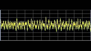 Lyme Disease  Rife Frequencies [upl. by Nevlin]