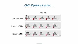 eLearning Ventilation modes ABC [upl. by Talanta42]