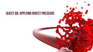 Stop arterial bleed direct pressure [upl. by Katey]