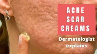 Acne Scar Creams  Dermatologist Reviews [upl. by Philipines687]