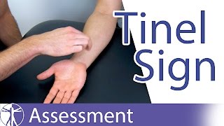 Tinel Sign Wrist  Carpal Tunnel Syndrome Diagnosis [upl. by Lirrad]