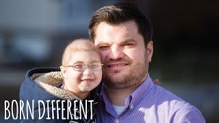 My Rare Dwarfism Makes Me 1 in 4 Million  BORN DIFFERENT [upl. by Ainedrag]