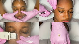 Summer Glow Facial w Microdermabrasion  GlamByLiaLeigh [upl. by Pillow]