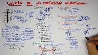 Lesión de la médula cervical  trauma vertebro medular [upl. by Oiratno]