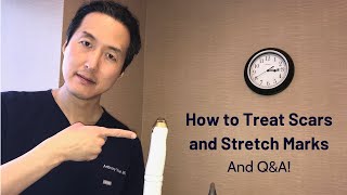 How to Treat Scars and Stretch Marks  Dr Anthony Youn [upl. by Einhpad18]