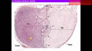 Neoplasia Nomenclature  Benign Tumors  Adenoma  Papilloma [upl. by Nerrual]