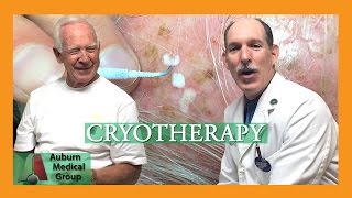 Actinic Keratosis Frozen with Cryotherapy  Auburn Medical Group [upl. by Ettezoj729]