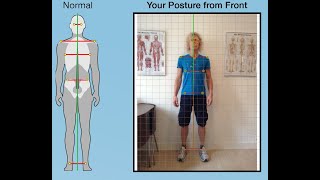 Postural Assessment Guide [upl. by Iharas]