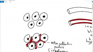 GENERAL PATHOLOGY 5  amyloidosis  structure  pathogenesis classification DR SAMEH GHAZY [upl. by Balliett]