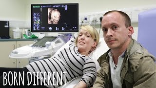 ‘UK’s Shortest Family’ Prepare For Second Baby  BORN DIFFERENT [upl. by Maribeth]