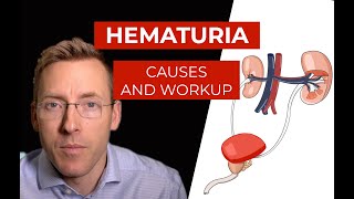 Hematuria causes and evaluation of blood in your urine [upl. by Kevon]