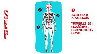 Comprendre la SEP en animation vidéo [upl. by Barbra]