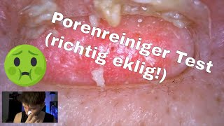 Mitesser Sauger  Entferner  Porenreiniger Test als MANN  Richtig Satisfying To Watch [upl. by Iinden286]