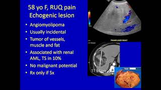 Liver Lesions [upl. by Cummine496]