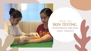 Intradermal InjectionSkin testing using Tomato [upl. by Nolham]