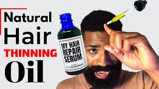 How To Apply MY Hair Repair Serum  Regrow Hairline [upl. by Rambert265]