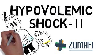 Hypovolemic Shock  Signs and Symptoms [upl. by Donall]