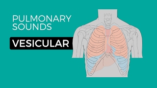 Difference Between a Monophasic and Biphasic Defibrillator [upl. by Tory930]