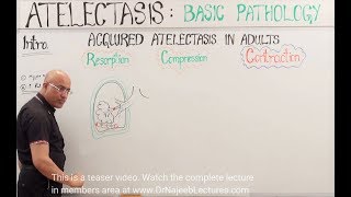 Atelectasis  Resorption Compression and Contraction [upl. by Euqinomod219]