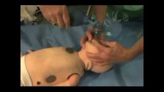 Bag Valve Mask BVM Ventilation in Pediatrics [upl. by Adieno871]