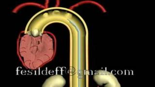 IABP Intraaortic Ballon Pump [upl. by Reginauld]