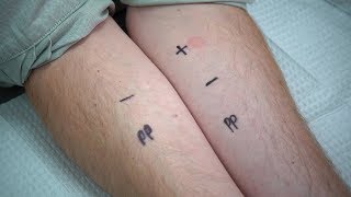 How to Administer an Intradermal Injection [upl. by Paterson357]