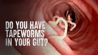 How to Survive Tapeworms Warning distressing footage [upl. by Gretna]