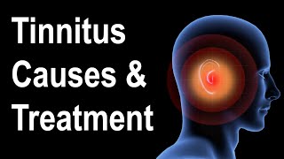 What is Tinnitus Causes amp Treatment Strategies [upl. by Broucek]