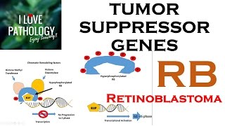 NEOPLASIA 3 TUMOR SUPPRESSOR GENES Retinoblastoma Gene Knudsons Two Hit Hypothesis [upl. by Ul]