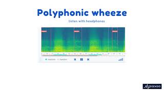 Lung sounds  polyphonic wheeze [upl. by Donough]