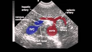 Aortic Surgery – Evaluating the Patient [upl. by Henriques]