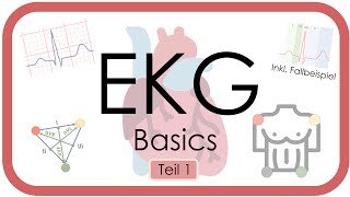 EKG Basics  Step by Step  Grundlagen Einthoven Frequenz Lagetyp PWelle QRS EKGKurs [upl. by Mages]